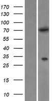 MTMR6 Human Over-expression Lysates NM_004685
