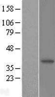 N myc interactor (NMI) Human Over-expression Lysates NM_004688