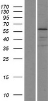 ls009119 krt75 human over expression lysates nm 004693 wb testing 1