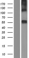 ls009120 mct7 slc16a6 human over expression lysates nm 001174166 wb testing 1