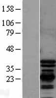 PDLIM1 Human Over-expression Lysates NM_020992