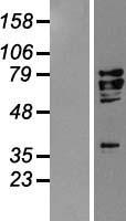 AIF (AIFM1) Human Over-expression Lysates NM_004208