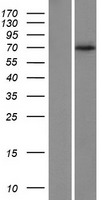 AIF (AIFM1) Human Over-expression Lysates NM_145812