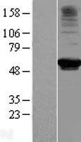 RRP9 Human Over-expression Lysates NM_004704