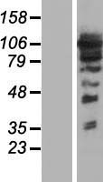 ARHGEF1 Human Over-expression Lysates NM_199002