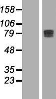 MTGR1 (CBFA2T2) Human Over-expression Lysates NM_001039709