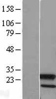 Apg12 (ATG12) Human Over-expression Lysates NM_004707