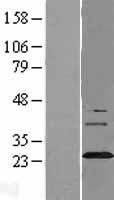 Synaptogyrin 3 (SYNGR3) Human Over-expression Lysates NM_004209