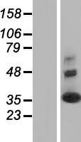 Synaptogyrin 2 (SYNGR2) Human Over-expression Lysates NM_004710