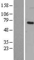 DYRK1B Human Over-expression Lysates NM_004714