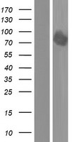 DYRK1B Human Over-expression Lysates NM_006483