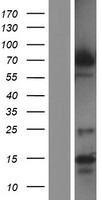 DYRK1B Human Over-expression Lysates NM_006484
