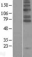 Glyt2 (SLC6A5) Human Over-expression Lysates NM_004211