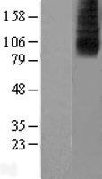 SLC28A2 Human Over-expression Lysates NM_004212
