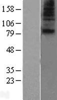 SLC28A1 Human Over-expression Lysates NM_004213