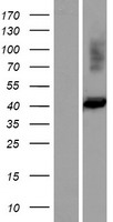 FIBP Human Over-expression Lysates NM_198897