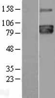 PCSK7 Human Over-expression Lysates NM_004716