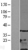 Thymosin beta 10 (TMSB10) Human Over-expression Lysates NM_021103