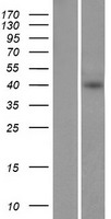 ST2 (IL1RL1) Human Over-expression Lysates NM_003856