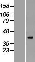 DEDD Human Over-expression Lysates NM_001039712