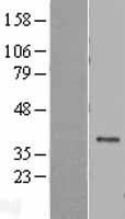 DEDD Human Over-expression Lysates NM_032998