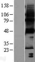 PTPLA (HACD1) Human Over-expression Lysates NM_014241