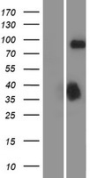 DCAMKL1 (DCLK1) Human Over-expression Lysates NM_004734