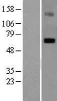LGI1 Human Over-expression Lysates NM_005097