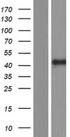 FAIM3 (FCMR) Human Over-expression Lysates NM_001193338