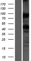 VAPA Human Over-expression Lysates NM_003574