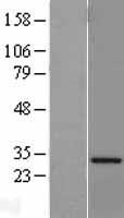 VAPA Human Over-expression Lysates NM_194434