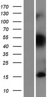 TIAF1 Human Over-expression Lysates NM_004740