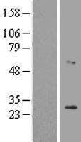 LRAT Human Over-expression Lysates NM_004744