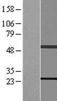 Rab11 (RAB11B) Human Over-expression Lysates NM_004218