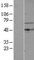 ls009238 tbrg4 human over expression lysates nm 004749 wb testing 1