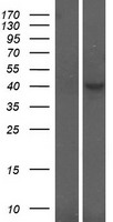 CRLF1 Human Over-expression Lysates NM_004750