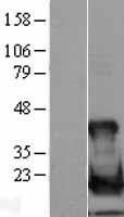 UBE2L6 Human Over-expression Lysates NM_004223