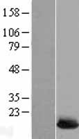 UBE2L6 Human Over-expression Lysates NM_198183