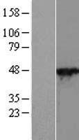 Cytohesin 2 (CYTH2) Human Over-expression Lysates NM_017457