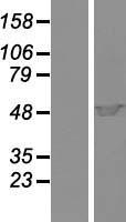 Cytohesin 1 (CYTH1) Human Over-expression Lysates NM_004762