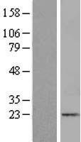 ITGB1BP1 Human Over-expression Lysates NM_004763