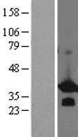ls009275 bcl7b human over expression lysates nm 001707 wb testing 2