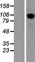 COPB2 Human Over-expression Lysates NM_004766