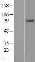 ZBTB22 Human Over-expression Lysates NM_005453
