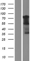 GPR56 (ADGRG1) Human Over-expression Lysates NM_201524