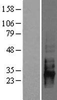 CD83 Human Over-expression Lysates NM_004233