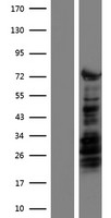 KLF4 Human Over-expression Lysates NM_004235