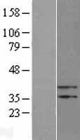 ls009317 pter human over expression lysates nm 001001484 wb testing 1