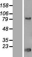 TRIP13 Human Over-expression Lysates NM_004237