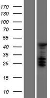 ASC1 (TRIP4) Human Over-expression Lysates NM_016213